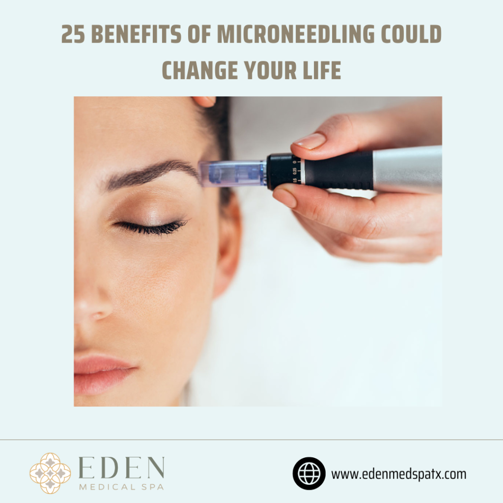 25 Benefits of Microneedling Could Change Your Life 1 1024x1024 1