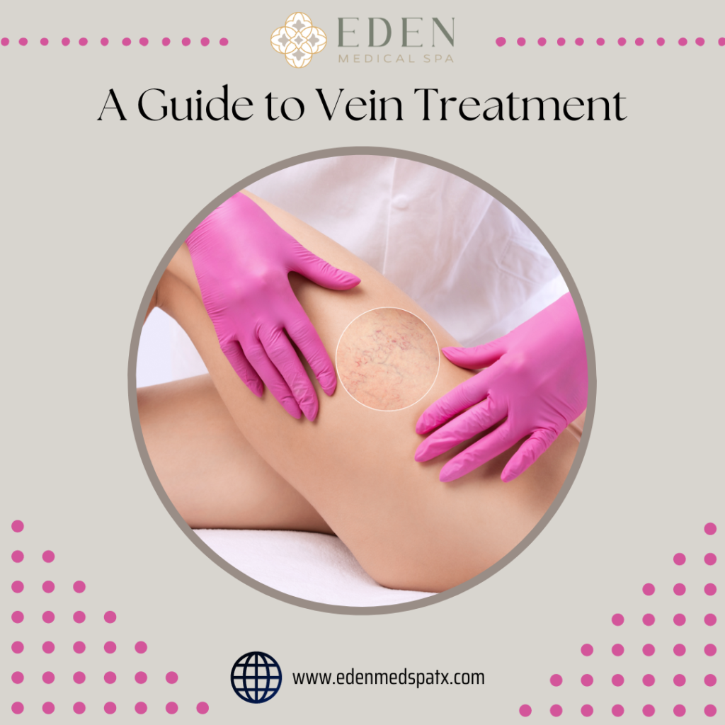A Guide to Vein Treatment 1024x1024 1