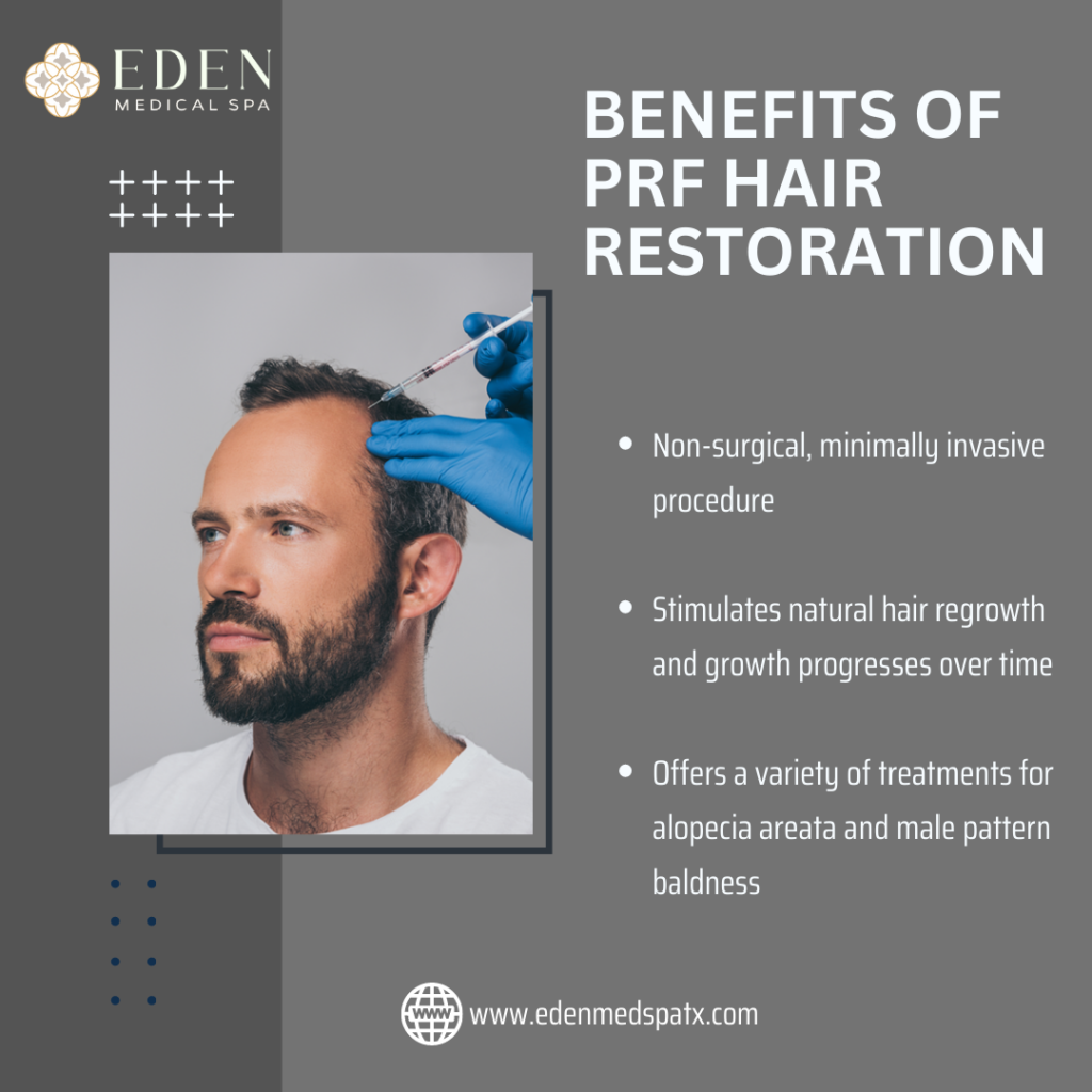 Benefits Of Prf Hair Restoration 1024x1024 1