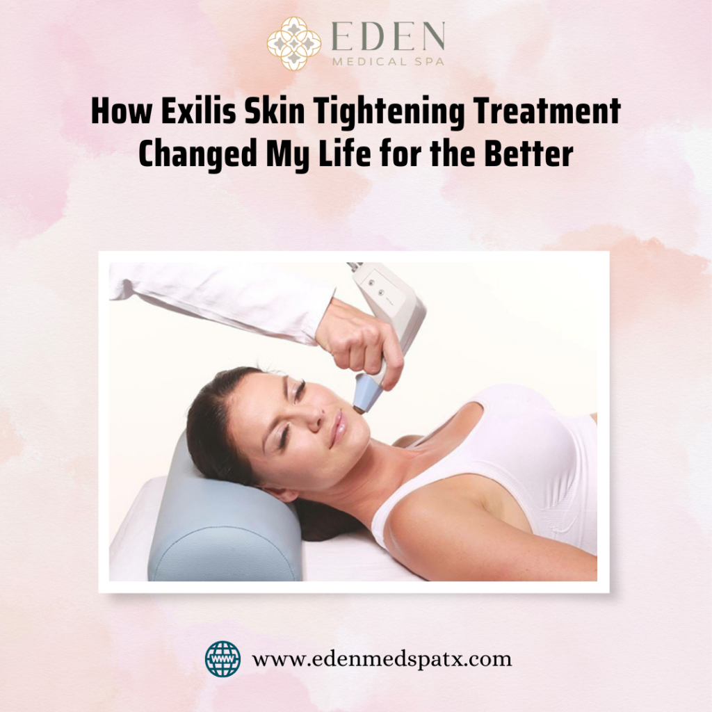How Exilis Skin Tightening Treatment Changed My Life for the Better 1024x1024 2