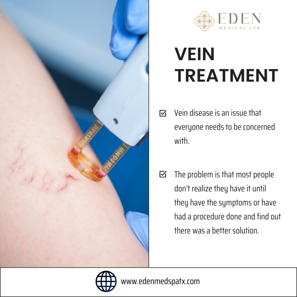 Vein Treatment 1024x1024 1