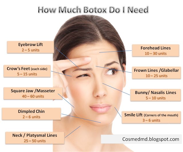How To Dilute Botox