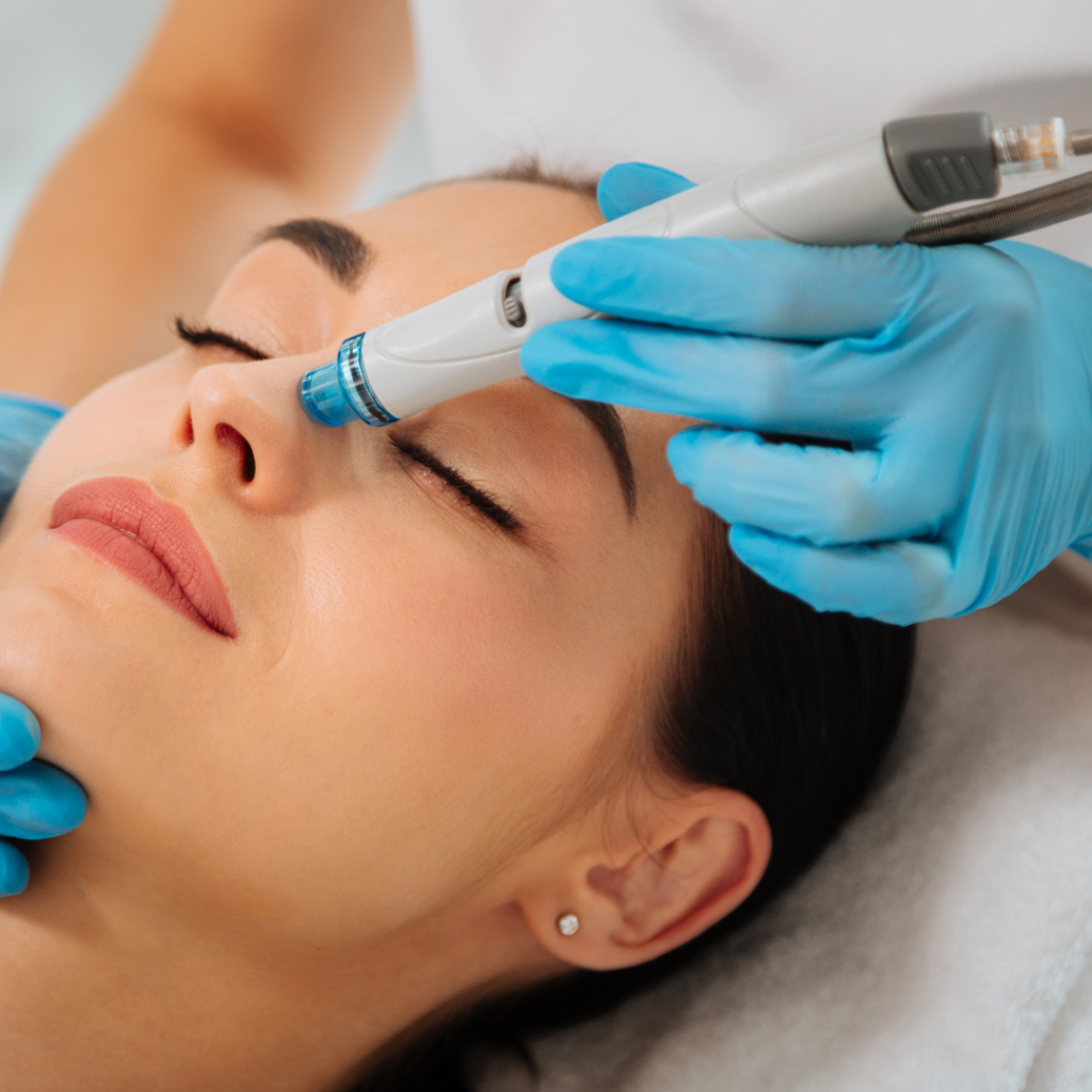 Hydrafacial (8)