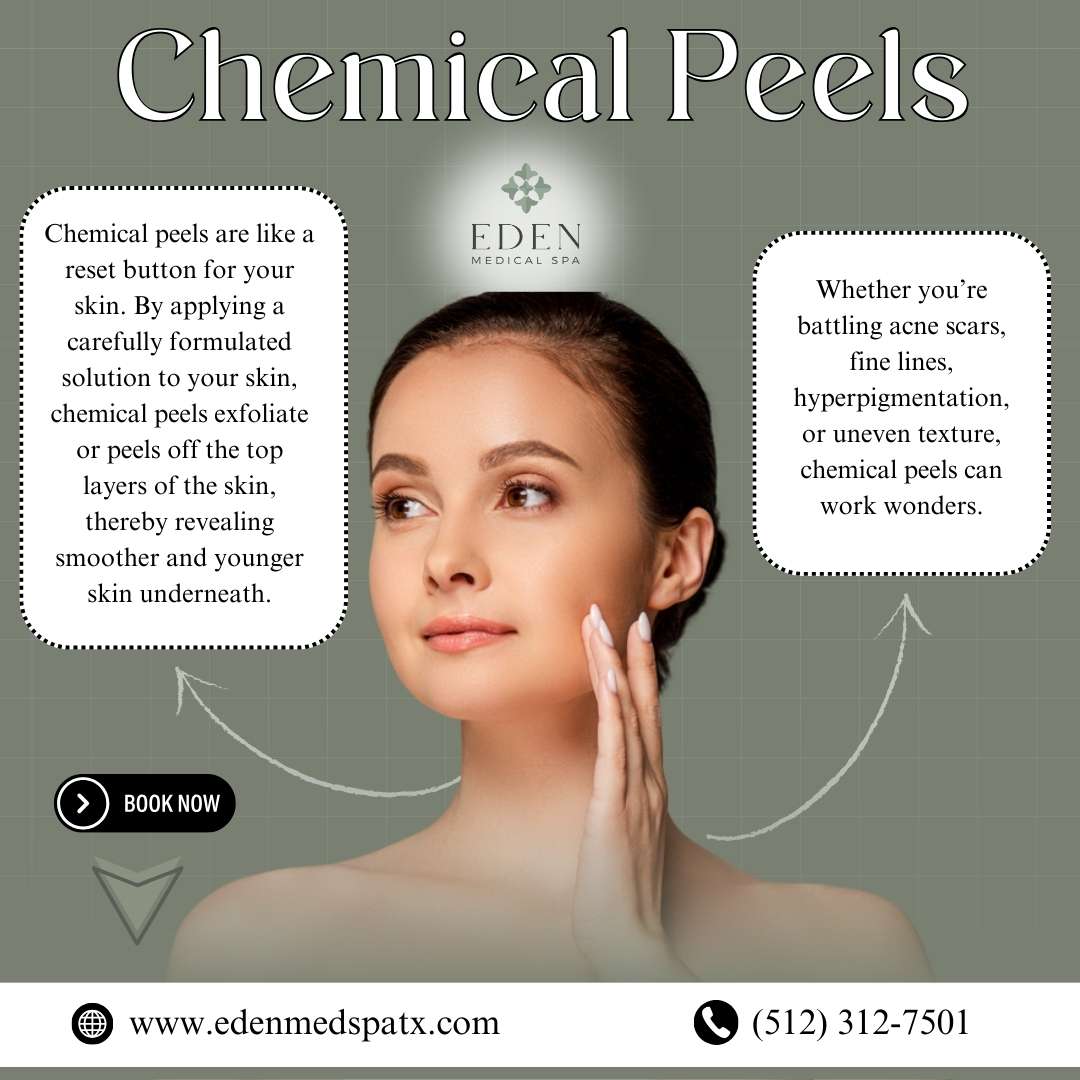 What Are Chemical Peels, and Why Are They So Popular?