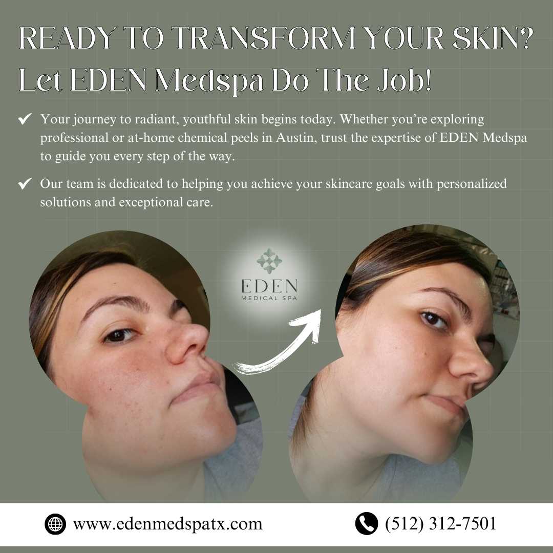 Ready to Transform Your Skin? Let EDEN Medspa Do The Job!